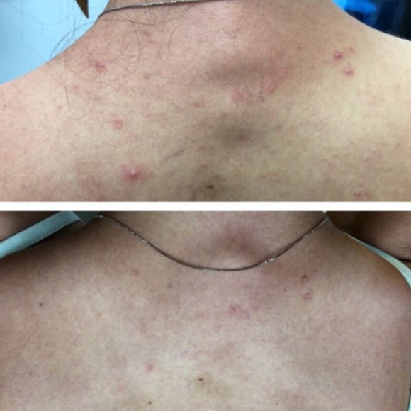 Koffee Beauty Scrub - Picture 9 of 11